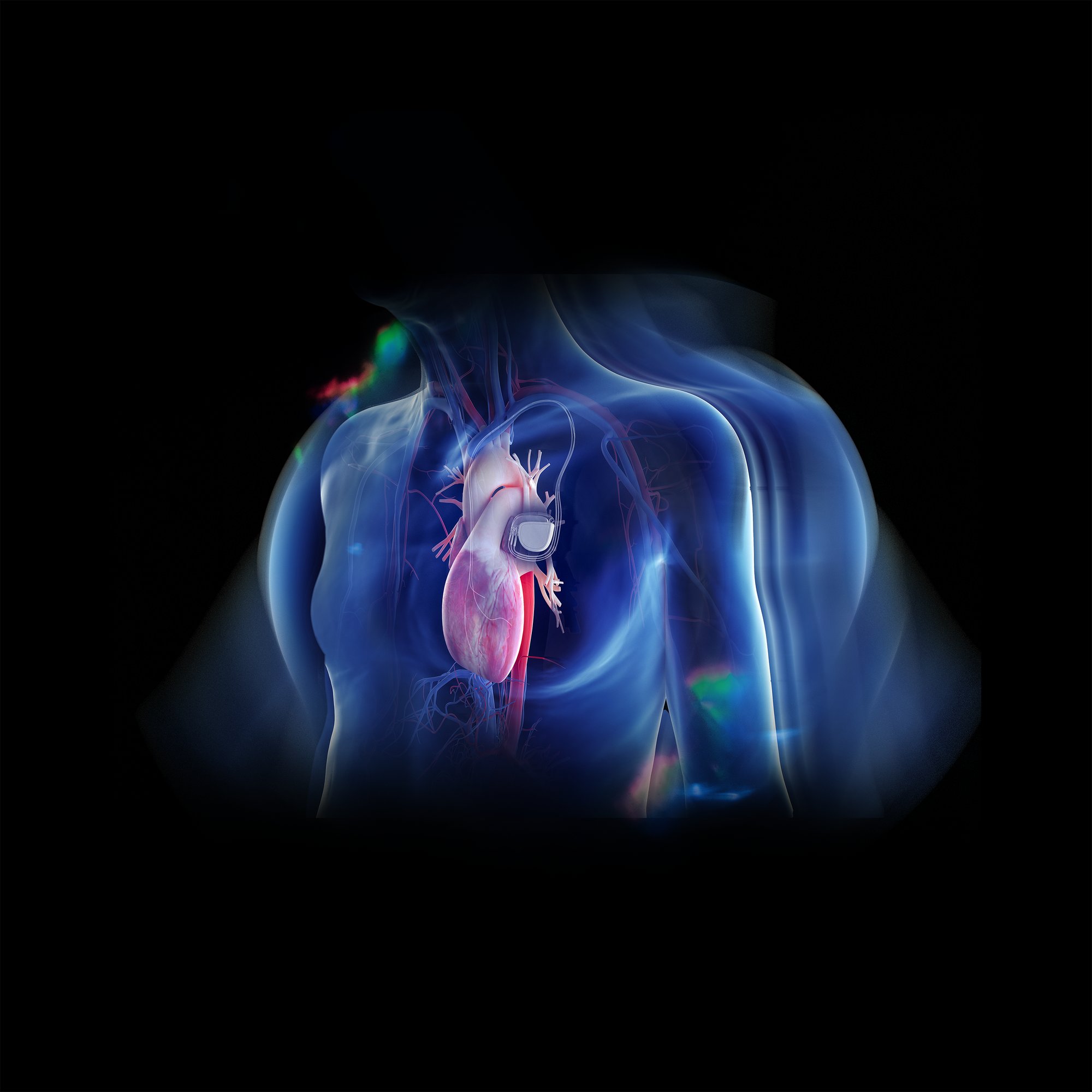 17_picosun_keyimage_pacemaker 17_picosun_keyimage_pacemaker